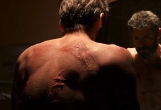 As cicatrizes de Hugh Jackman no trailer de Logan