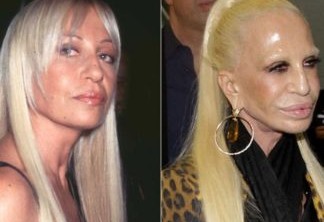 Donatella Versace, antes e depois
