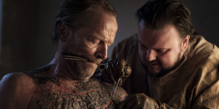 Game of Thrones | Ator revela “bombas e baldes de pus” em cena desagradável do segundo episódio